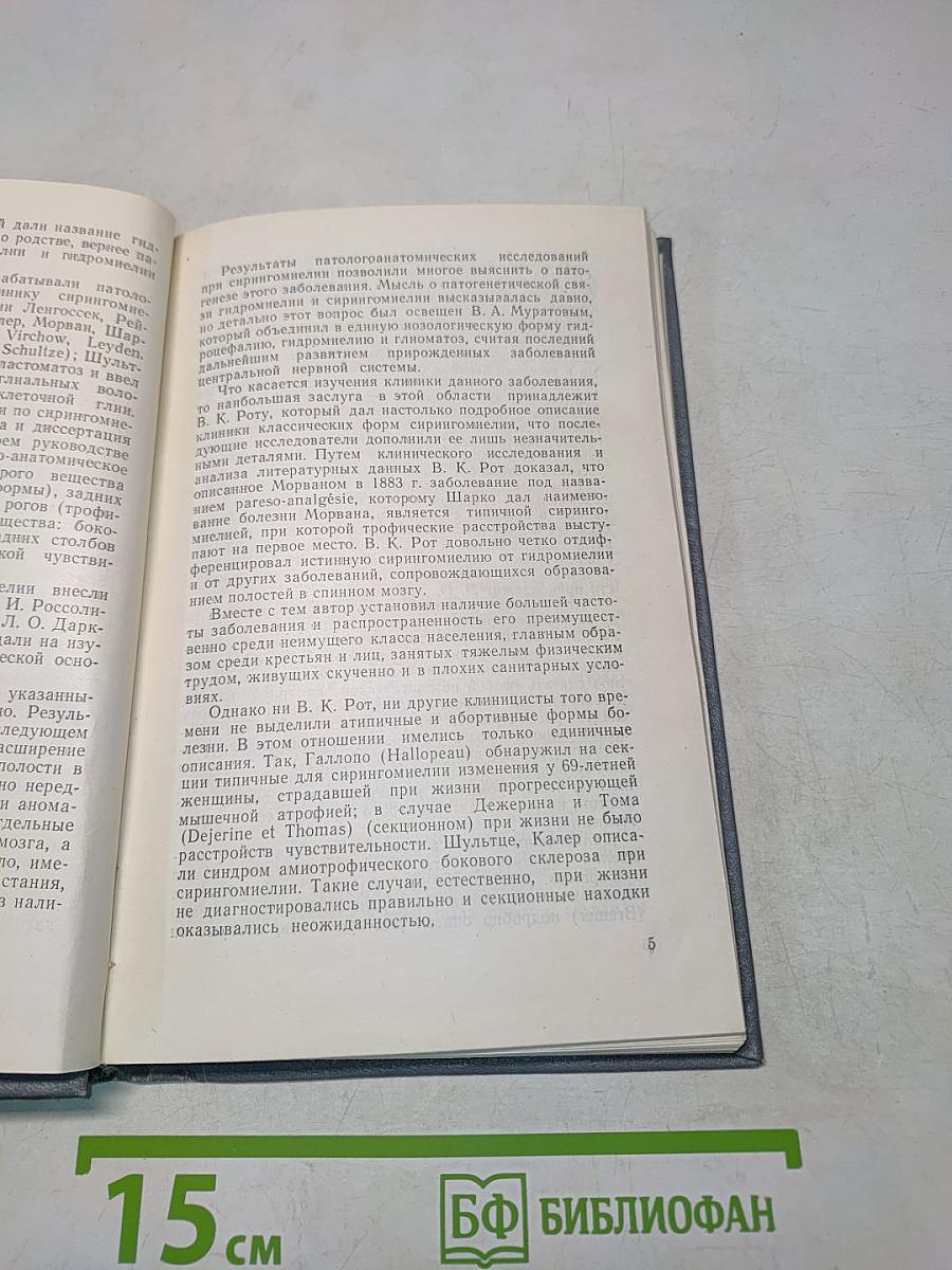 Сирингомиелия