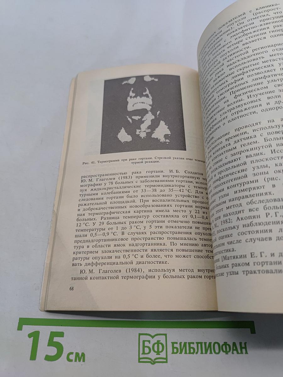 Диагностические и тактические ошибки при раке гортани