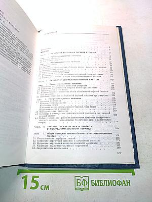 Пост-реанимационная болезнь