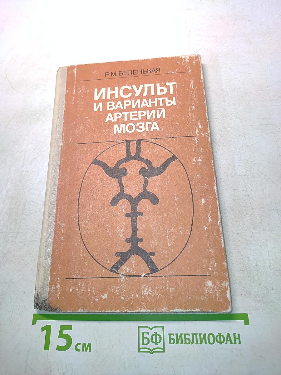 Инсульт и варианты артерий мозга