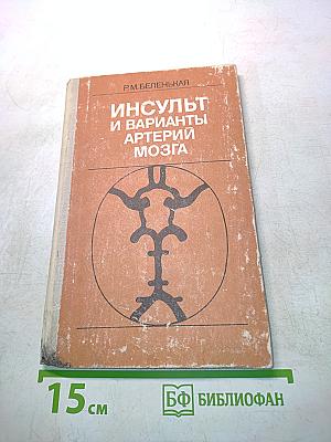 Инсульт и варианты артерий мозга