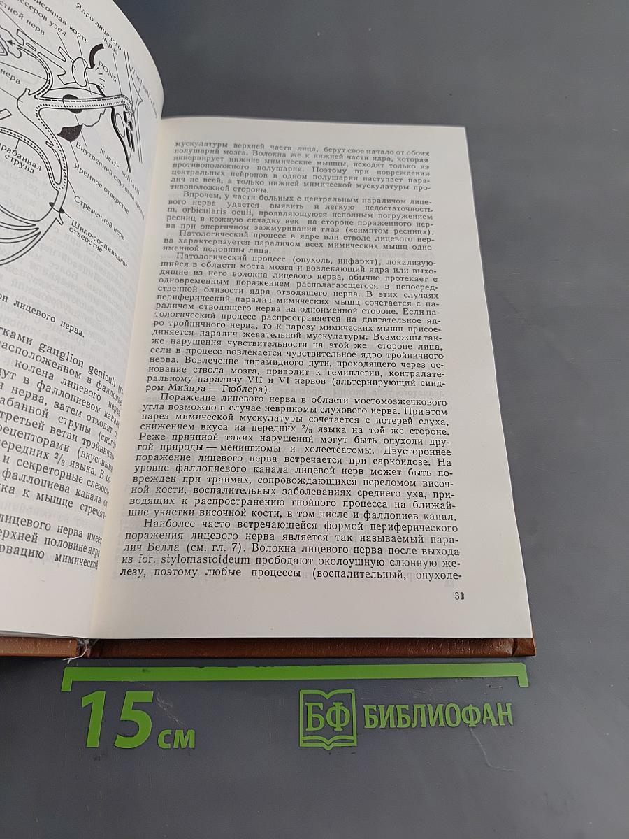 Болезни нервной системы (Руководство для врачей) Том I