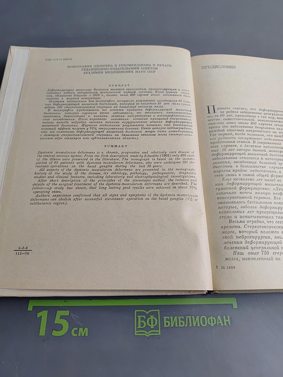 Деформирующая мышечная торсионная дистония (клиника и хирургическое лечение)