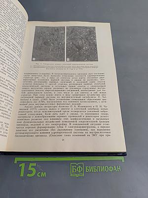 Клиническая электрокардиография. Нарушения сердечного ритма и проводимости