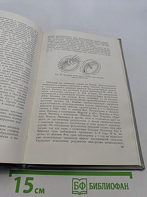 Искусственное кровообращение в хирургии сердца и магистральных сосудов
