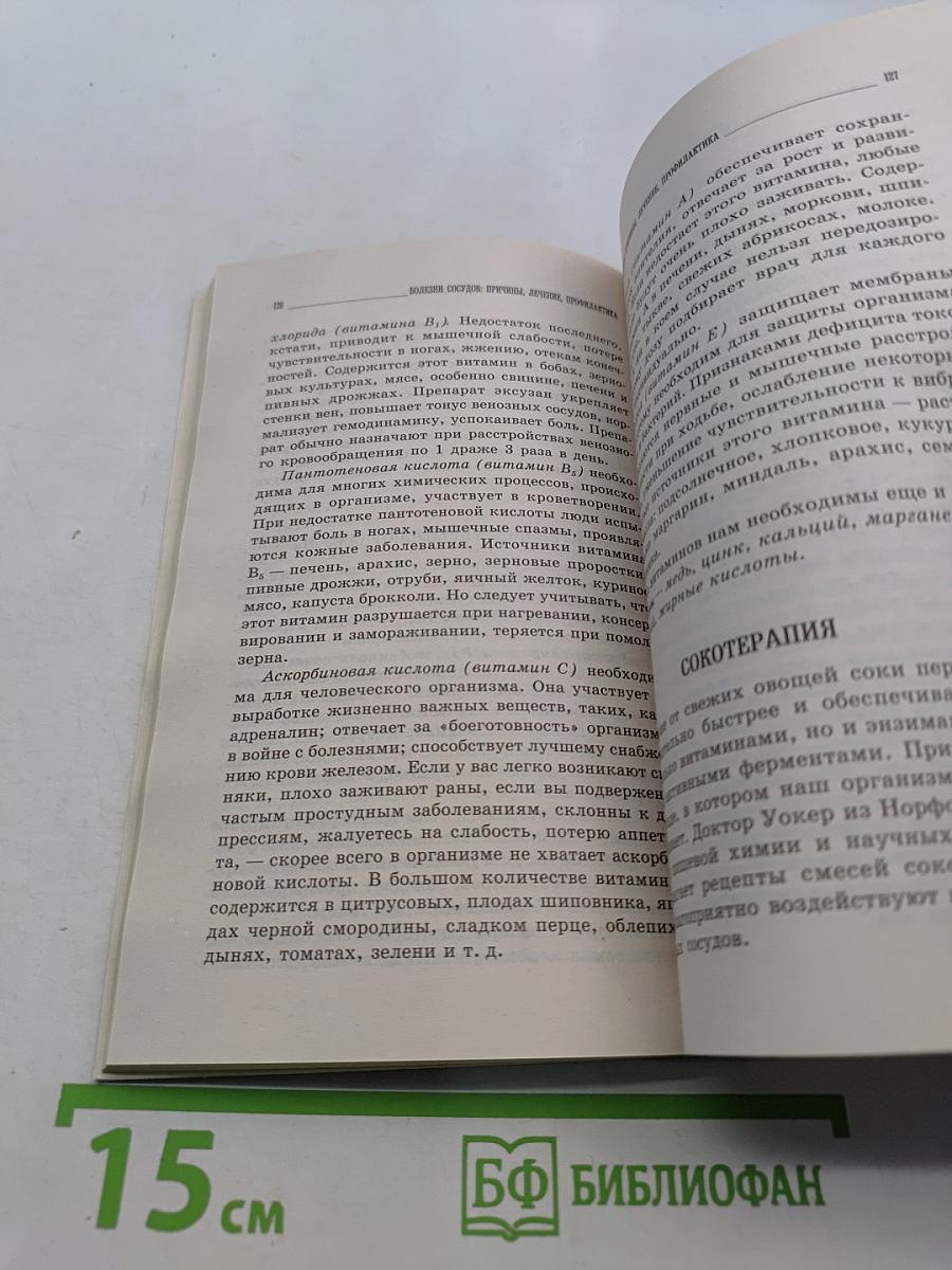 Болезни сосудов: причины, лечение, профилактика