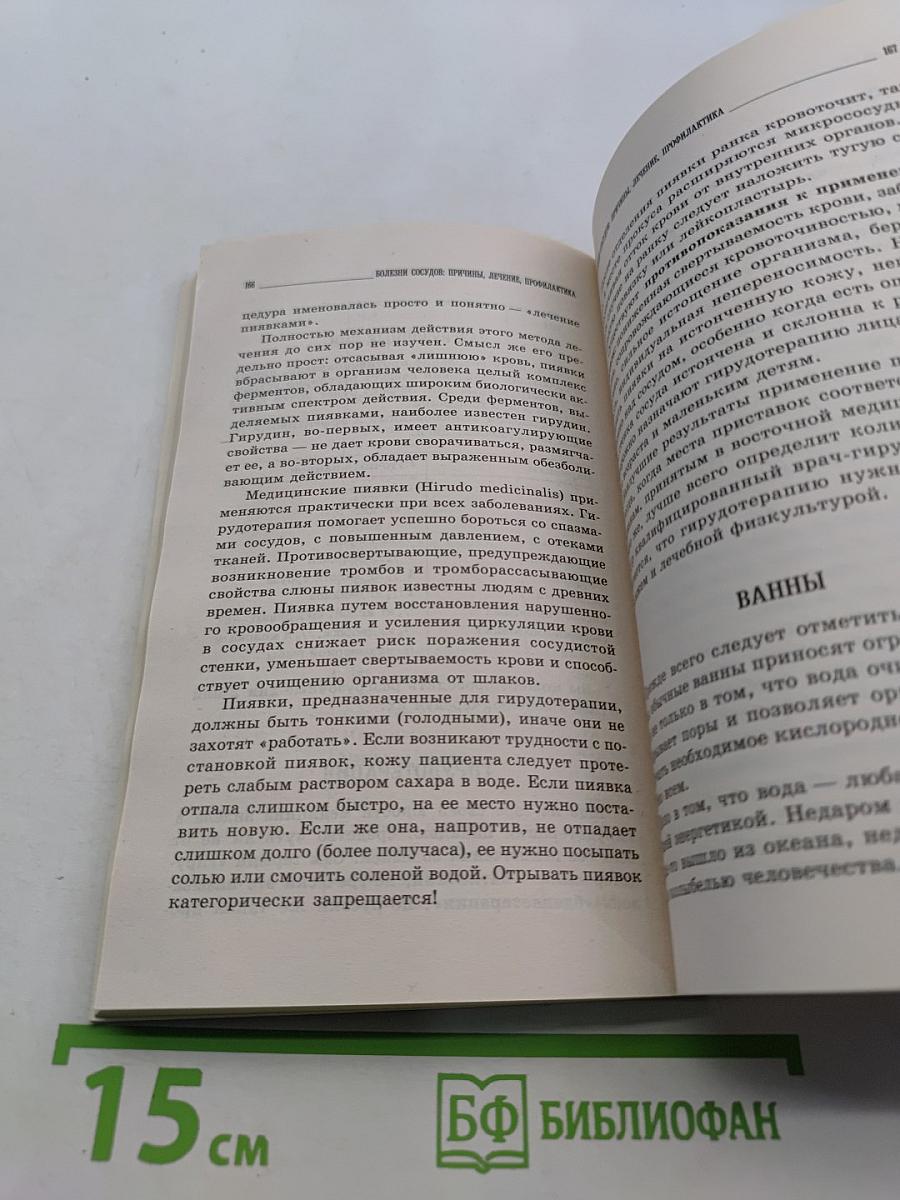 Болезни сосудов: причины, лечение, профилактика