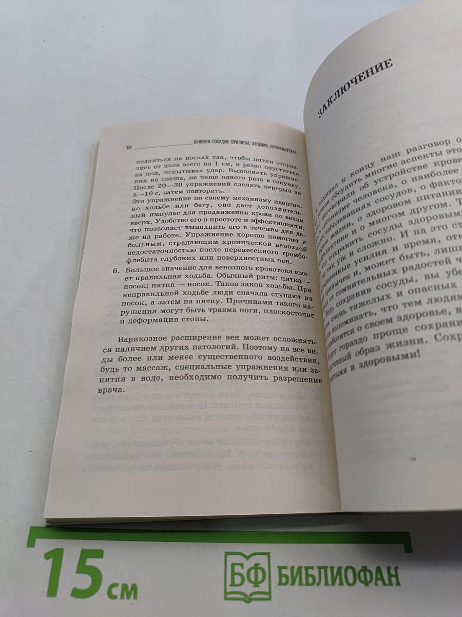 Болезни сосудов: причины, лечение, профилактика