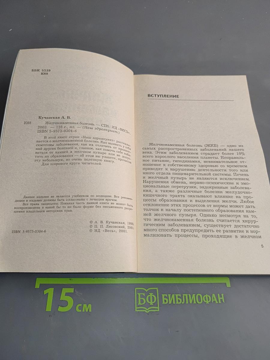 Желчно-каменная болезнь