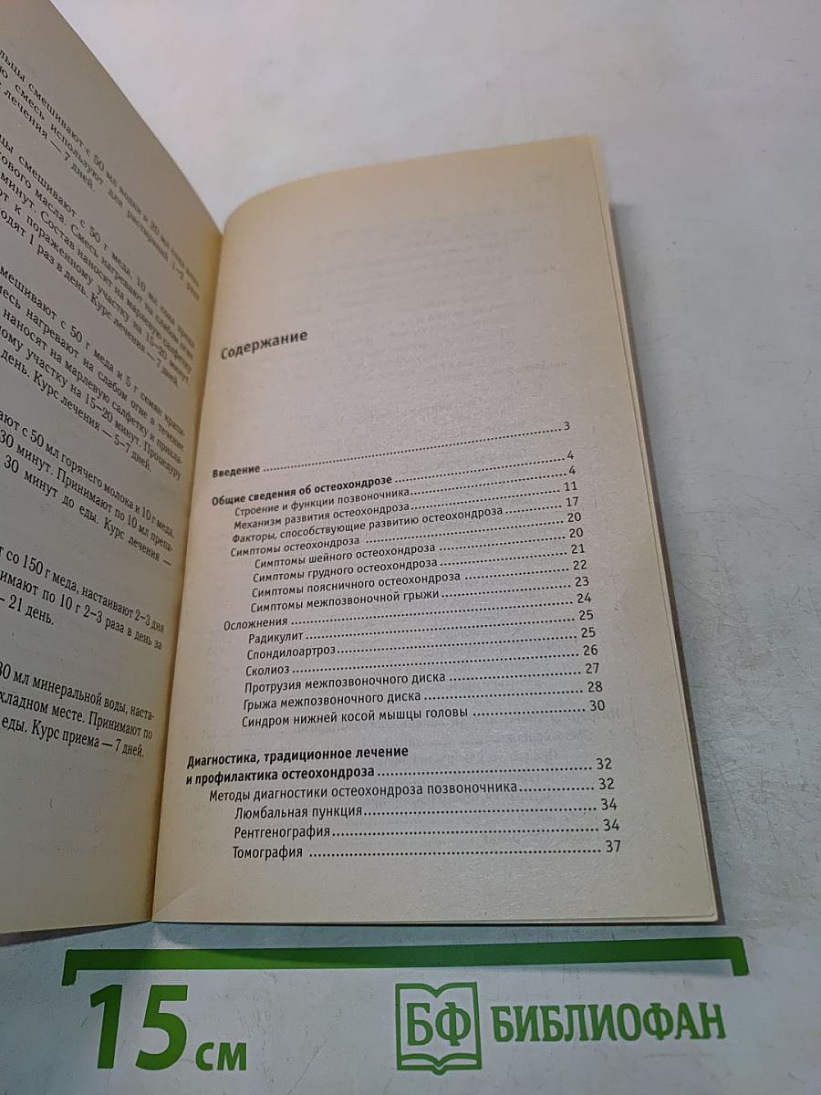 Остеохондроз. Диагностика, профилактика, лечение