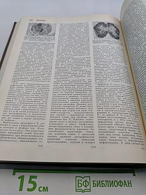 Большая медицинская энциклопедия. Том 20. Пневмопексия — Преднизолон