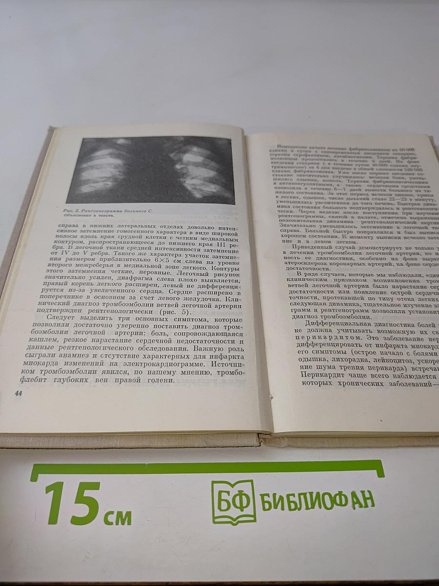 Очерки неотложной кардиологии