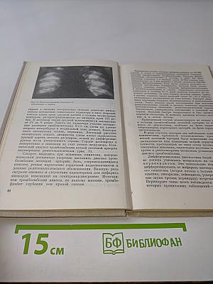 Очерки неотложной кардиологии