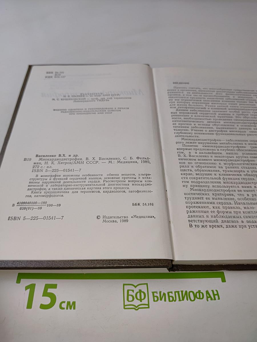 Миокардиодистрофия