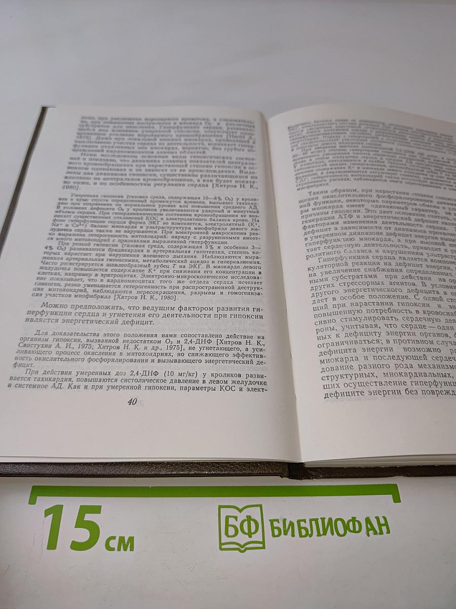 Миокардиодистрофия
