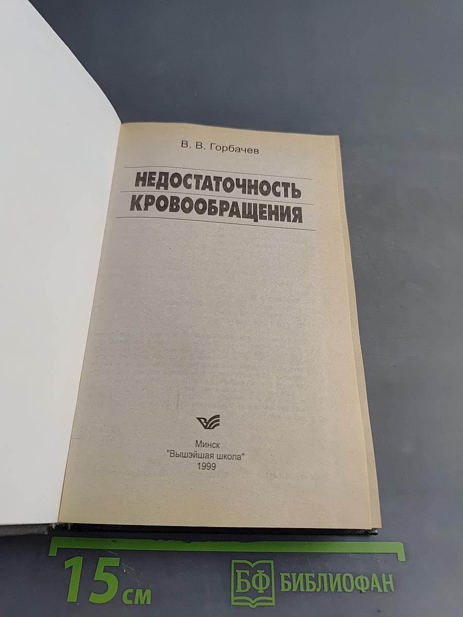 Недостаточность кровообращения