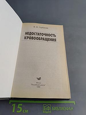 Недостаточность кровообращения