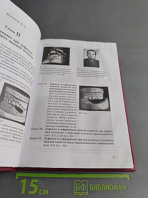Челюстно-лицевое протезирование. Ортопедические методы лечения дефектов челюстно-лицевой области