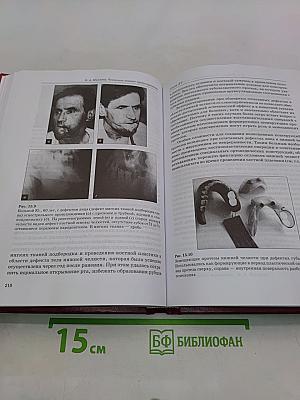 Челюстно-лицевое протезирование. Ортопедические методы лечения дефектов челюстно-лицевой области
