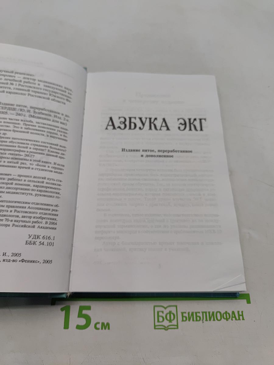 Азбука ЭКГ и боли в сердце