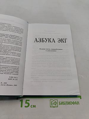 Азбука ЭКГ и боли в сердце