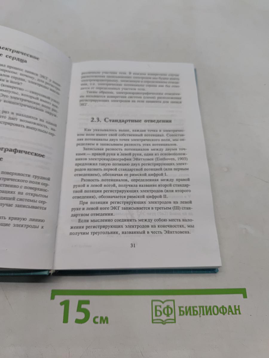 Азбука ЭКГ и боли в сердце