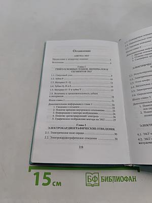 Азбука ЭКГ и боли в сердце