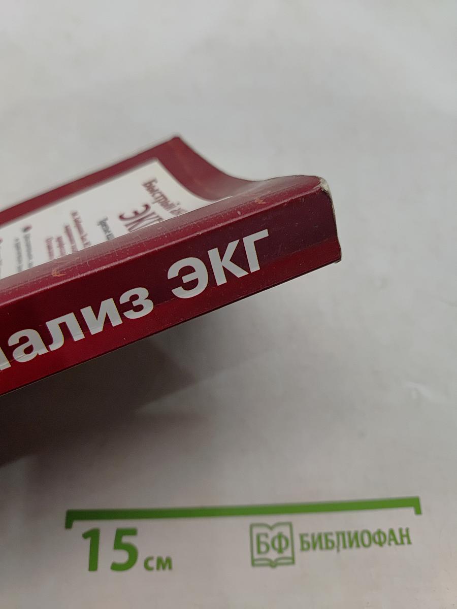 Быстрый анализ ЭКГ. Третье издание