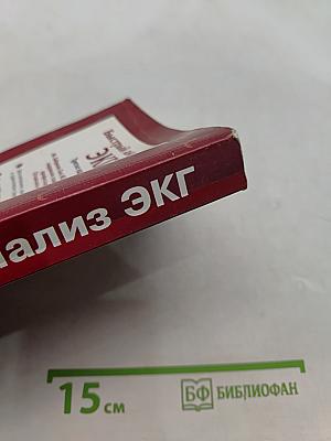 Быстрый анализ ЭКГ. Третье издание