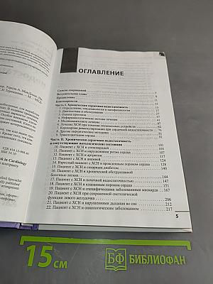 Сердечная недостаточность