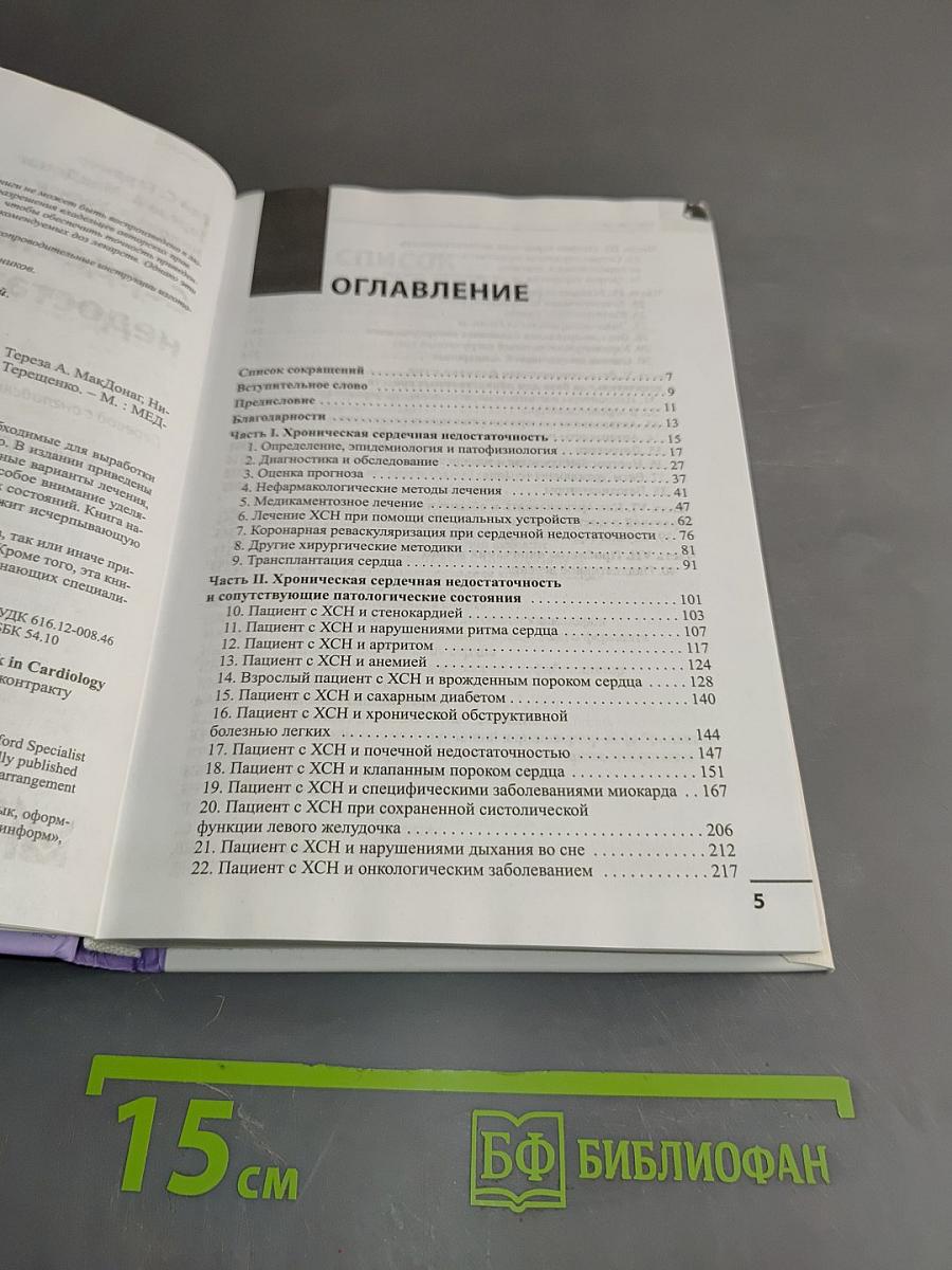 Сердечная недостаточность