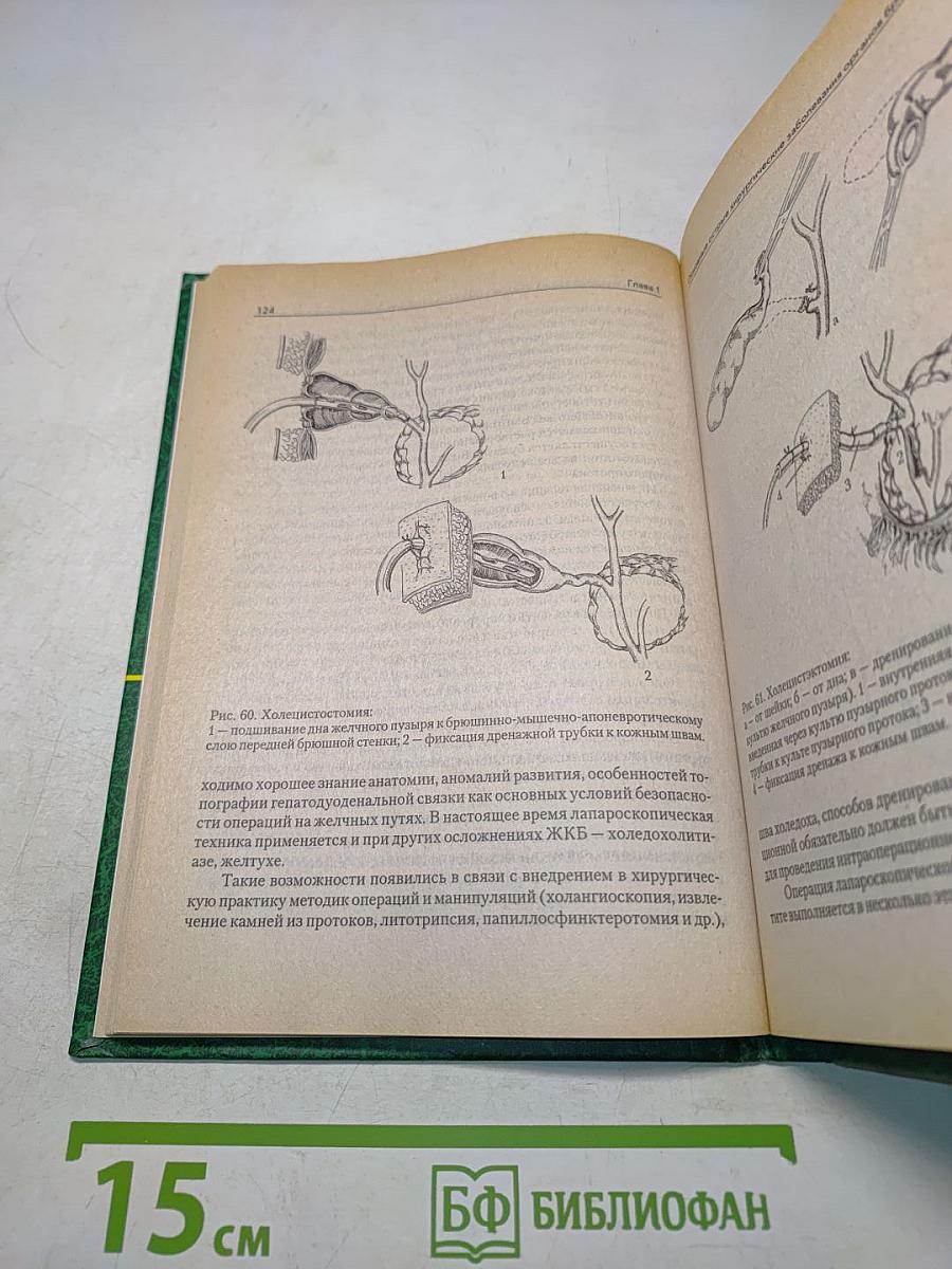 Неотложная абдоминальная хирургия. Практикум