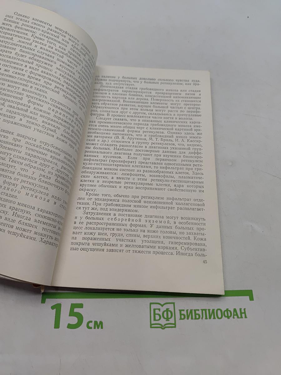 Системные заболевания кожи