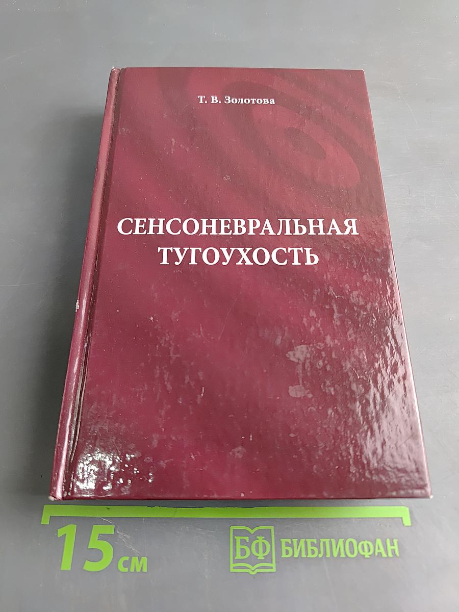 Сенсоневральная тугоухость
