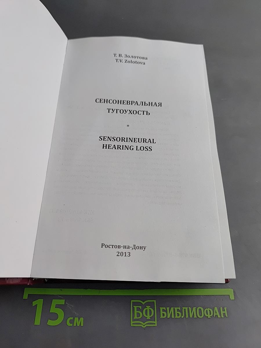 Сенсоневральная тугоухость