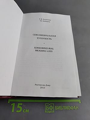 Сенсоневральная тугоухость