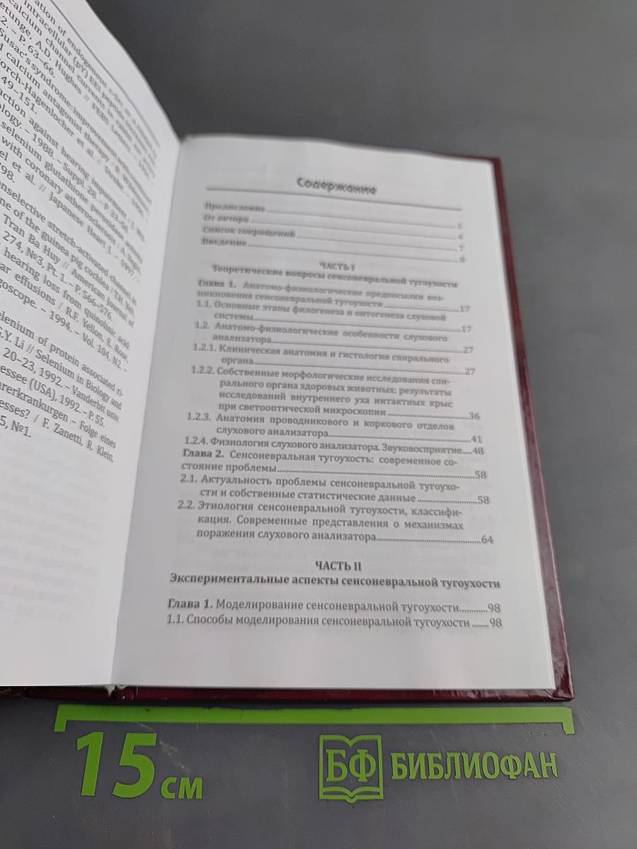 Сенсоневральная тугоухость