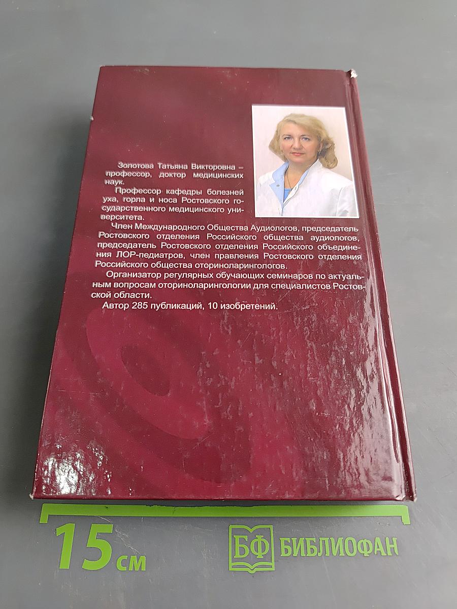 Сенсоневральная тугоухость