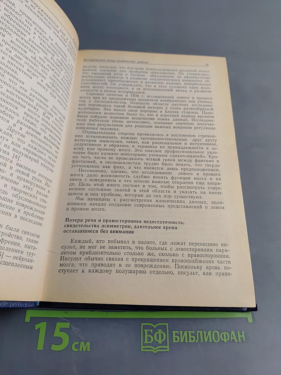 Левый мозг, правый мозг: Асимметрия мозга