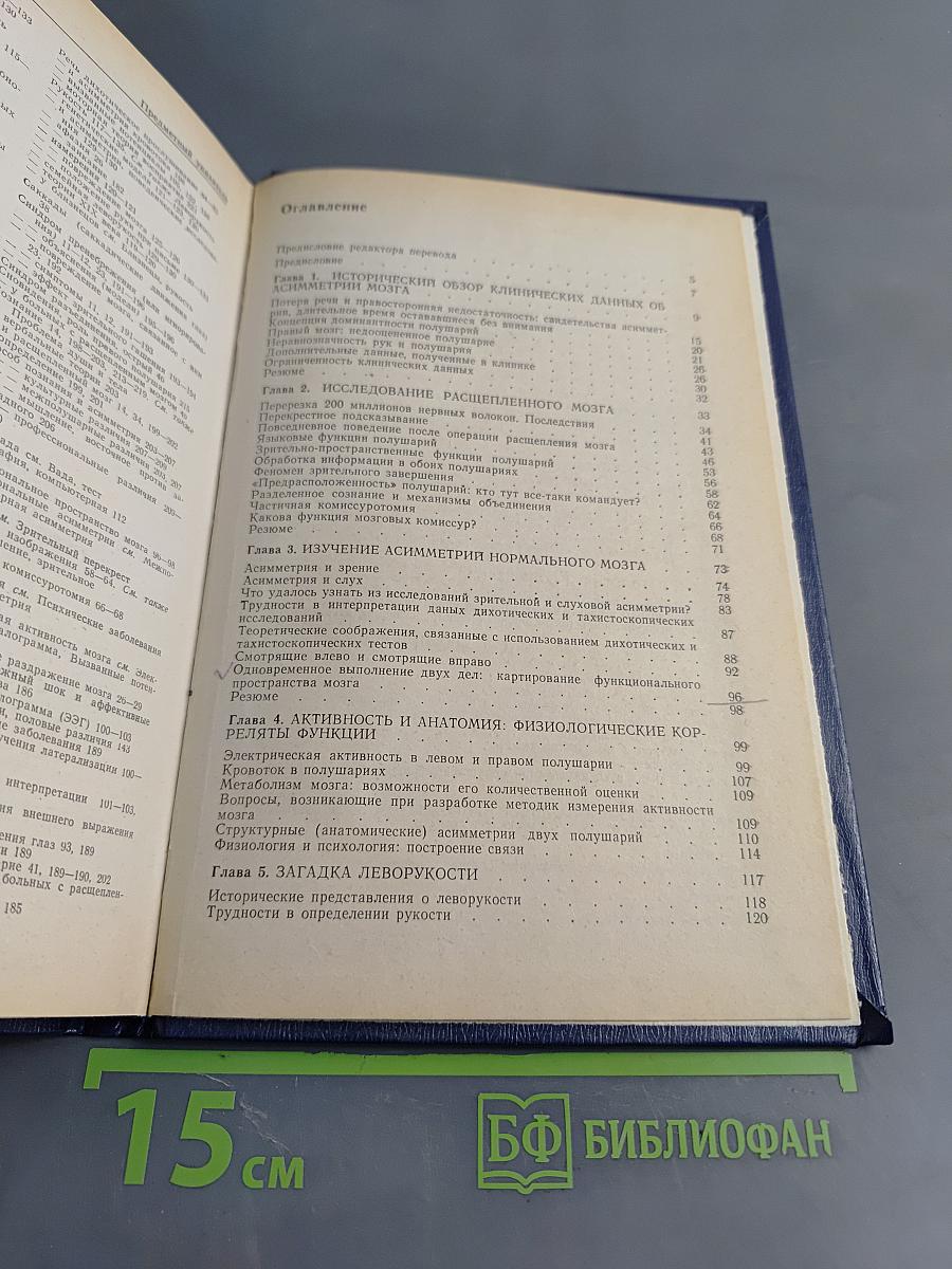 Левый мозг, правый мозг: Асимметрия мозга