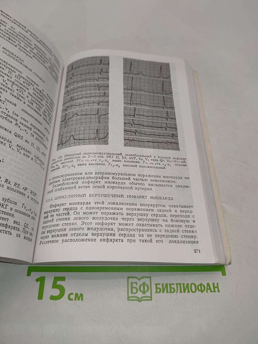 Руководство по электрокардиографии
