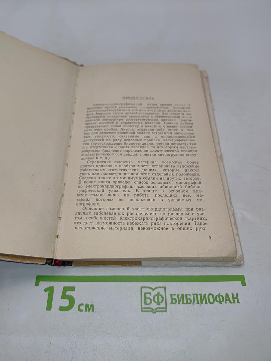 Практический анализ электрокардиограмм