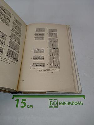 Практический анализ электрокардиограмм