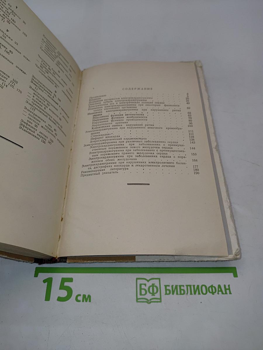 Практический анализ электрокардиограмм