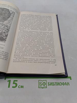 Патологическая анатомия коронарной недостаточности