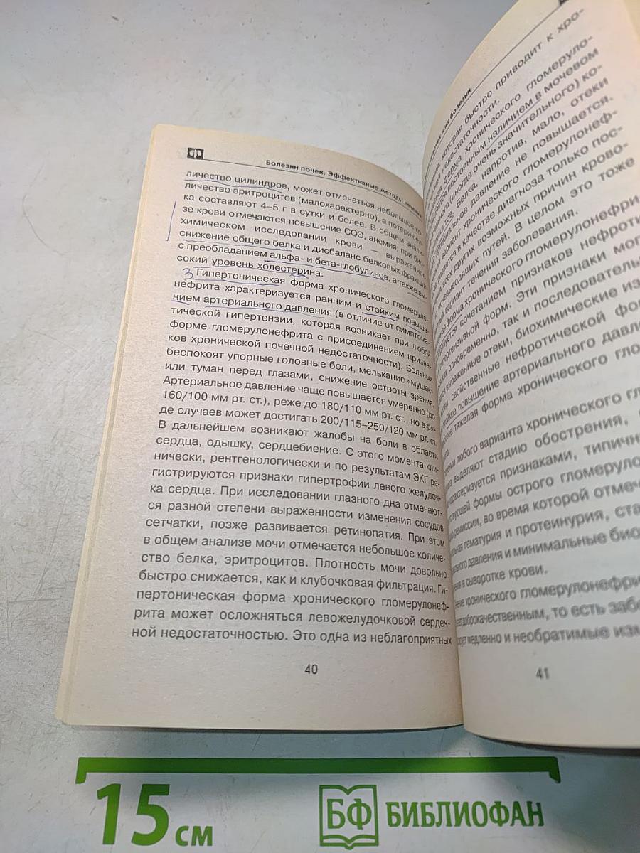 Болезни почек: эффективные способы лечения