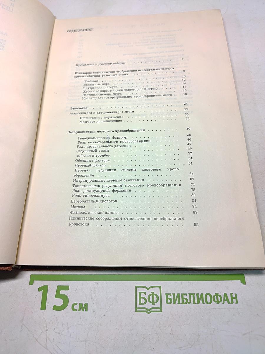 Церебральный инфаркт и церебральное кровоизлияние