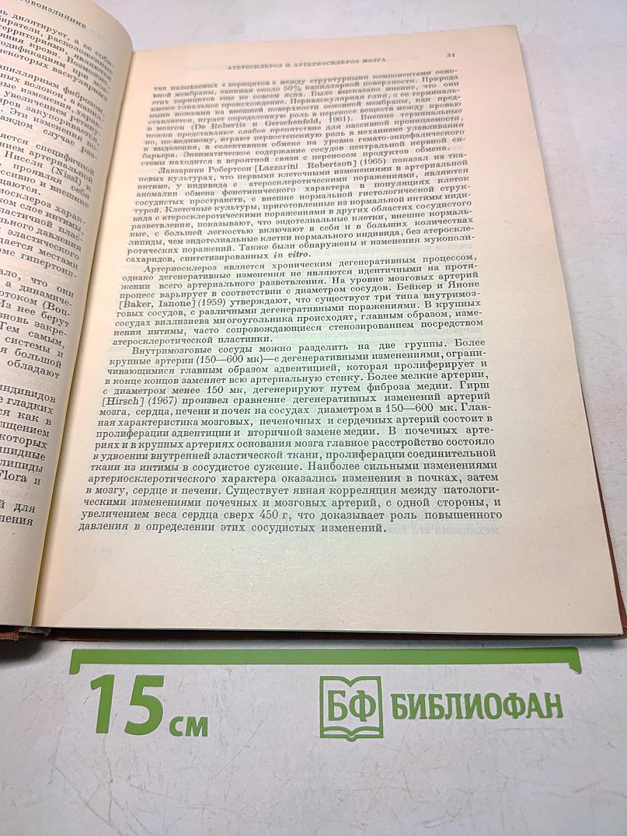 Церебральный инфаркт и церебральное кровоизлияние