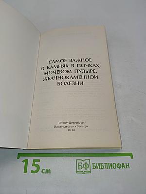 Самое важное о камнях в почках, мочевом пузыре, желчнокаменной болезни