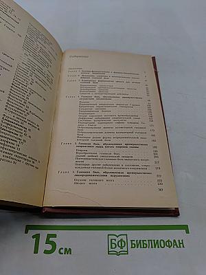 Головная боль